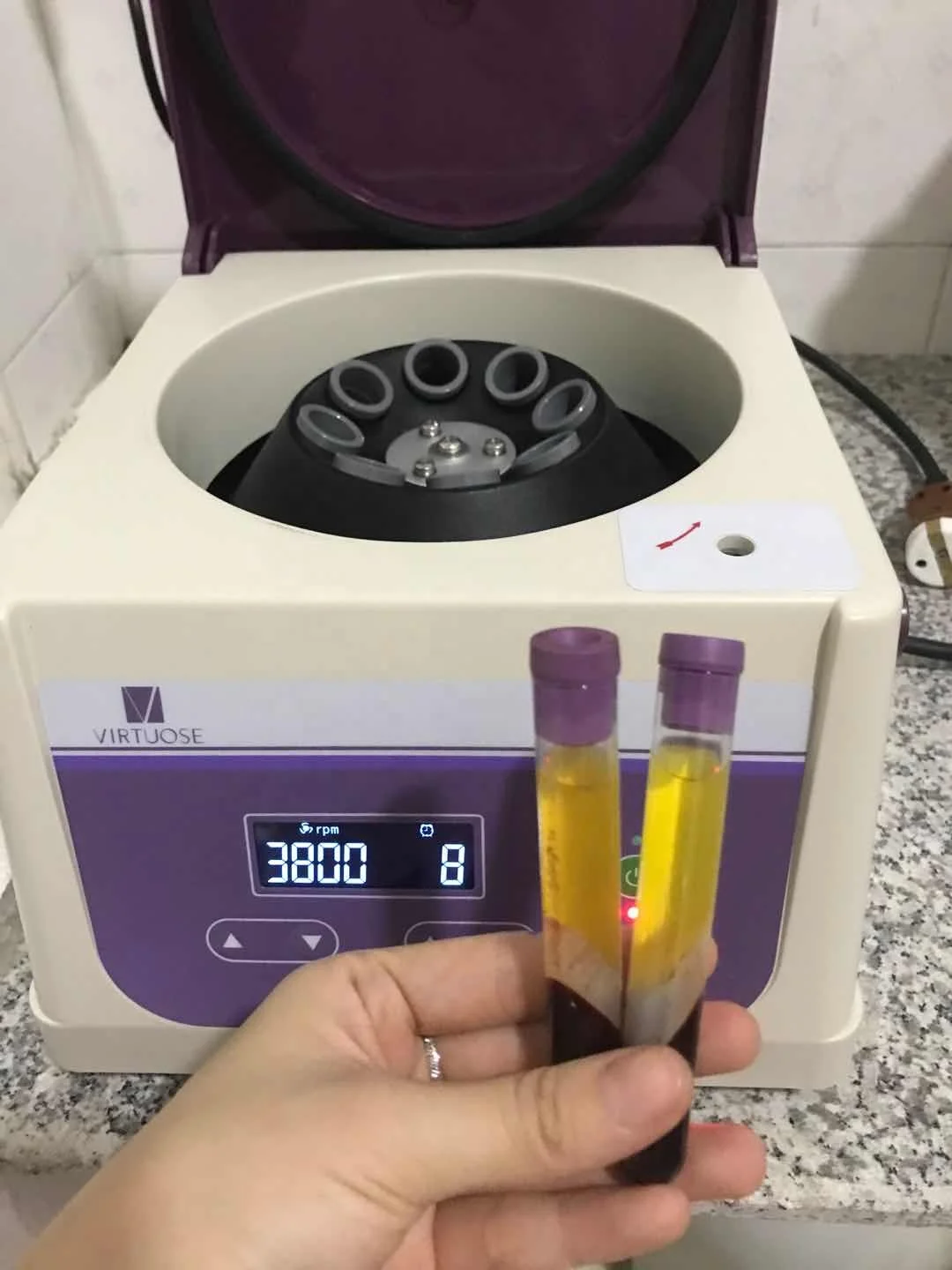 Виртуоза плазменный гель PRP трубки графин центрифуга машина для продажи