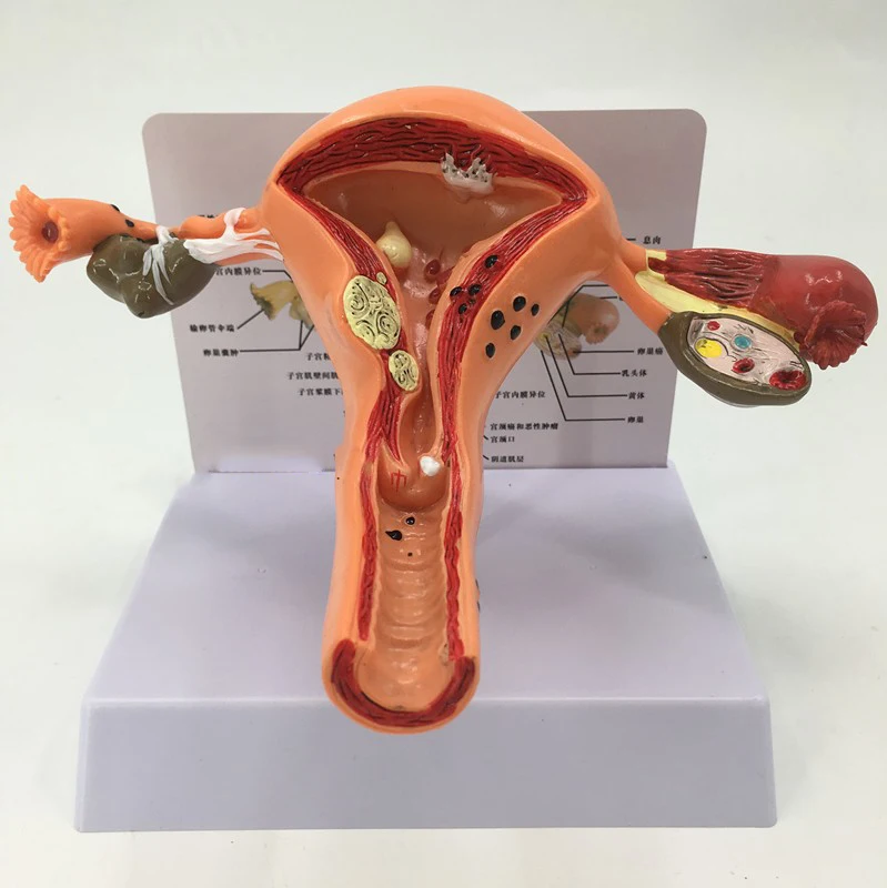Medical Female Model Reproductive Structure Anatomical Model Human ...