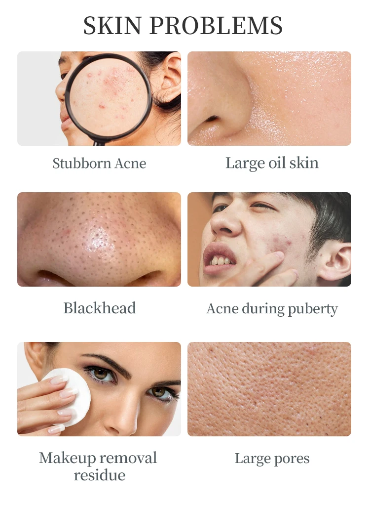 Amino Acid Moisturizingbubble Face Mask Deep Cleaning Oil Control Skin