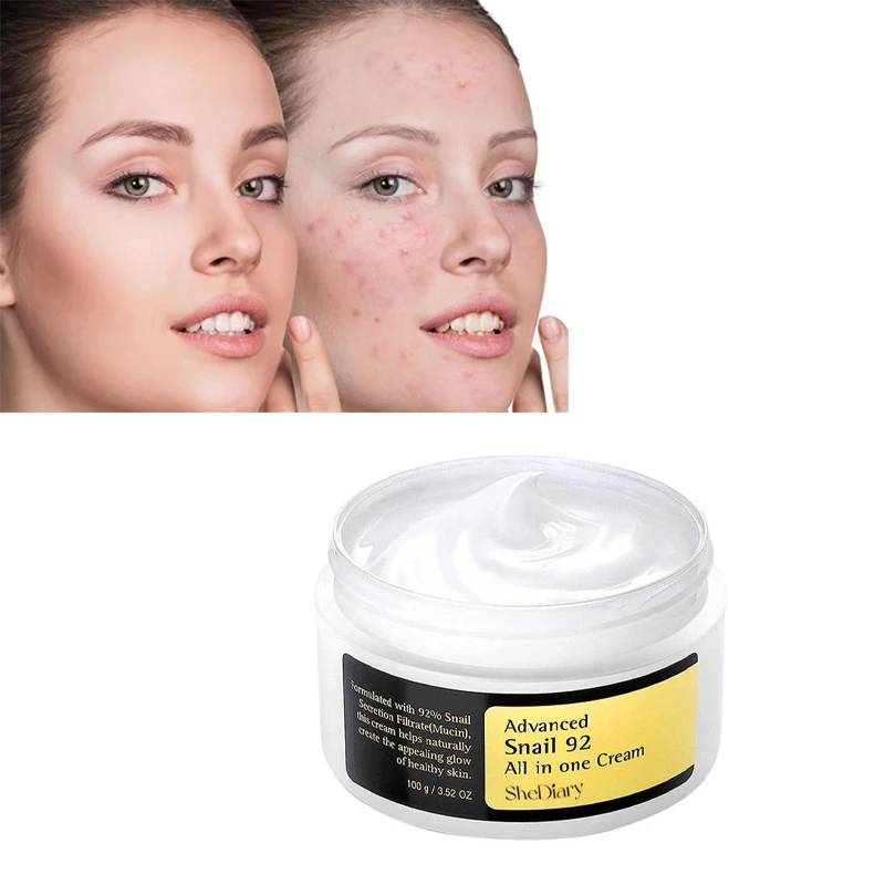 Shediary Private Label Snail White Cream Mucin Advanced Snail 96 Mucin Power Essence Wholesale Face Snail Cream