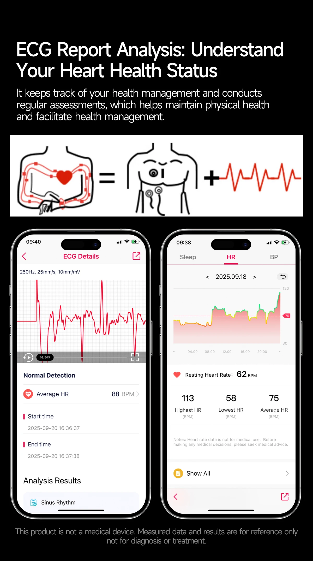 If you are searching for a supplier of a product with perfect quality control and highly competitive prices, which gives you an advantage in expanding your local market, then contact us now!  Competitive suppliers of   2026 TK27 ECG Health Monitor Smart Watch Multiple Exercise Modes IP68 Blood Pressure &Sleep Monitoring Smartwatch