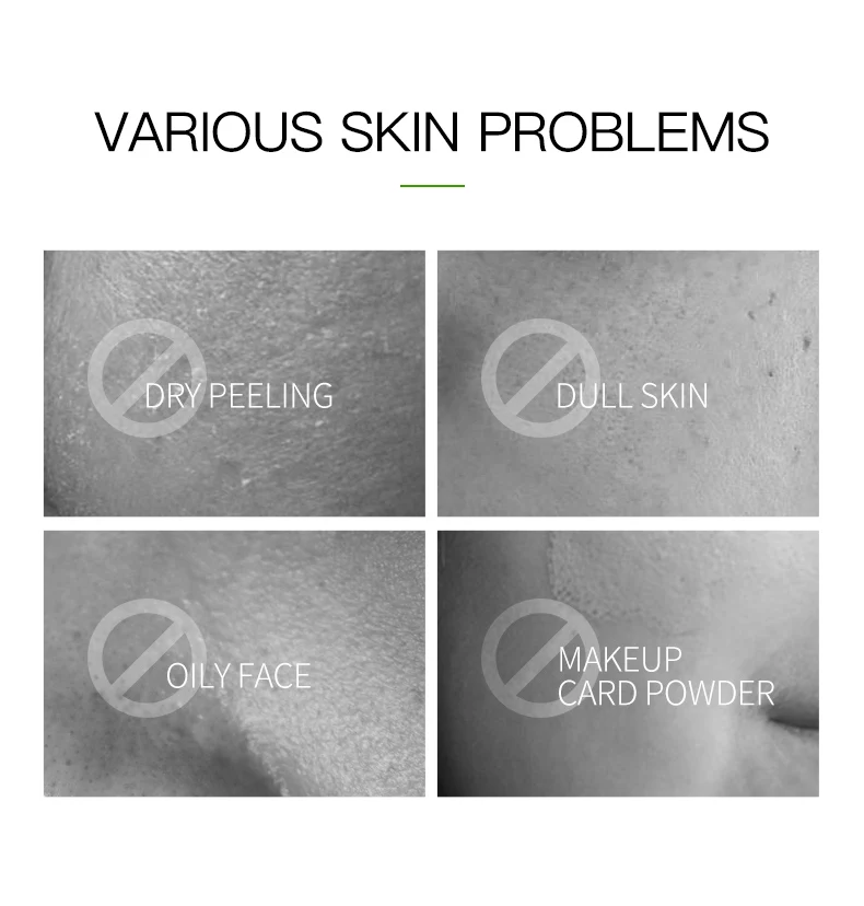 Wholesale Aloe Moisturizing Facial Mask Improve Dry And Rough Skin