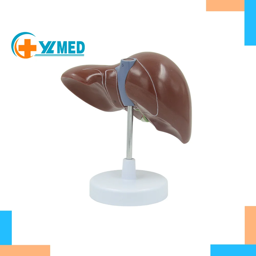 Medical Supplies Human Teaching Liver Pathological Model for School Display Tool Lab Equipment