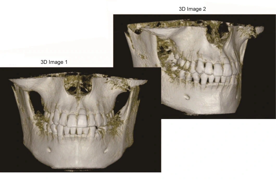 High Quality Digital Radiography 3D CBCT Panoramic Dental X-ray Machine, Teeth Xray Scanner manufacture