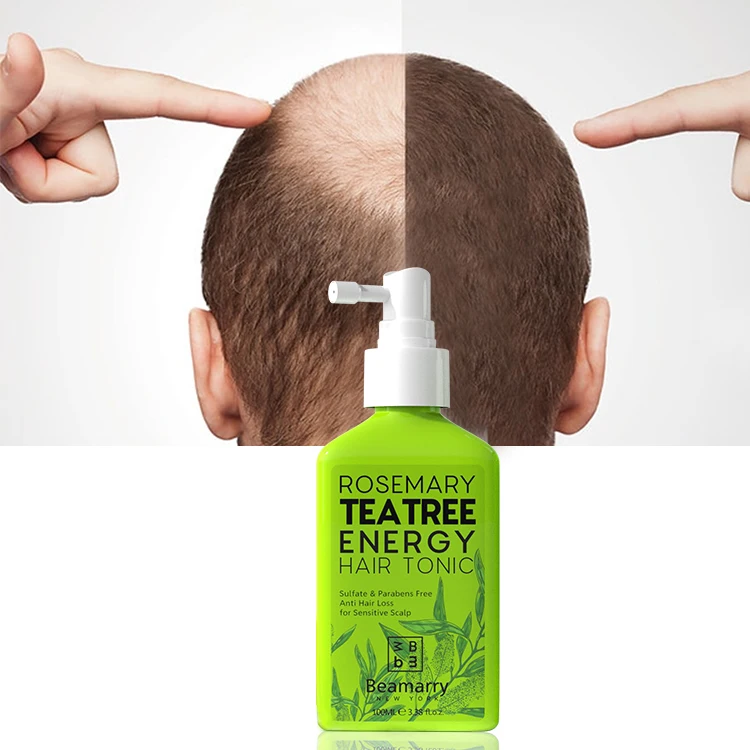 New Product Hair Tonic Spray Anti Loss Hair Treatment Repair Damage Oem  Private Label Hair Tonic For Sensitive Scalp - Buy Hair Tonic,Hair Tonic  Spray,Hair Tonic Oem Product on 