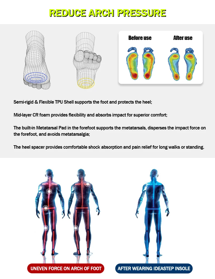 Production Of Orthopedic Insoles Plantar Fasciitis Plantar Fasciitis