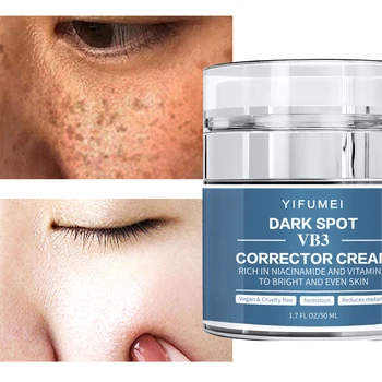 Facial Freckle Whitening Black Correcting Skin Brightening Lightening Hyperpigmentation Treatment Dark Spot Remover Cream