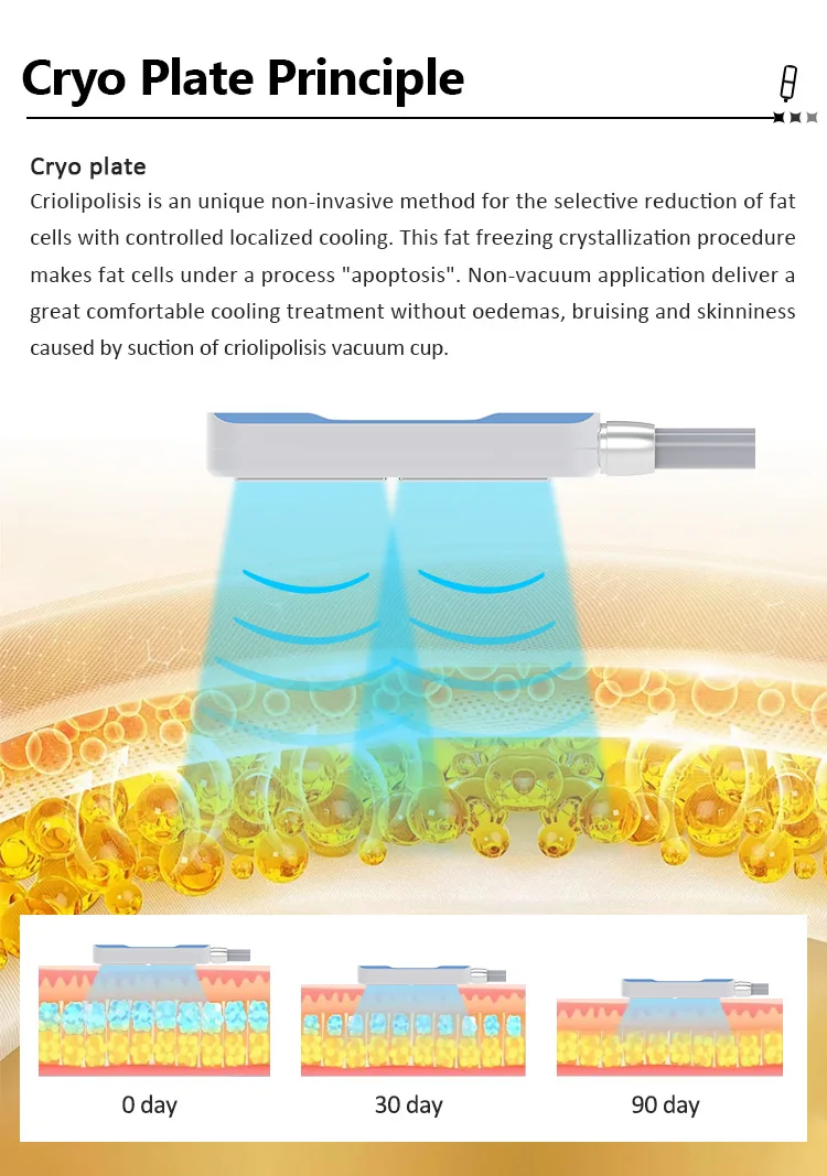 8 Pads Cryo Lipolysis Cryotherapy Fat Freezing Body Sculpting Machine 12 Discover the professional 8 Pads Cryo Lipolysis Cryotherapy Machine for non-invasive fat freezing, body sculpting, slimming, and advanced cryotherapy contouring treatments for salons and med spas. 8 Pads Cryo Lipolysis Cryotherapy Fat Freezing Body Sculpting Machine