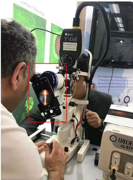 Universal Smartphone Photo Adapter for Slit Lamp Microscope and Operation Microscope iPhone Adapter