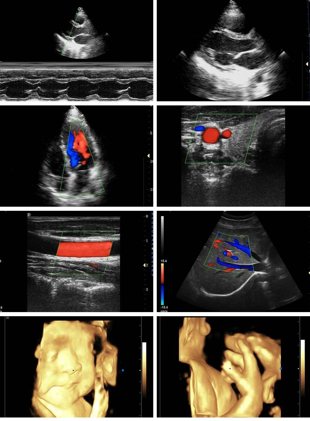 High Quality 13.3 Inch Touch Screen 4D Trolley Color Doppler Ultrasound Ultrasound Machine manufacture