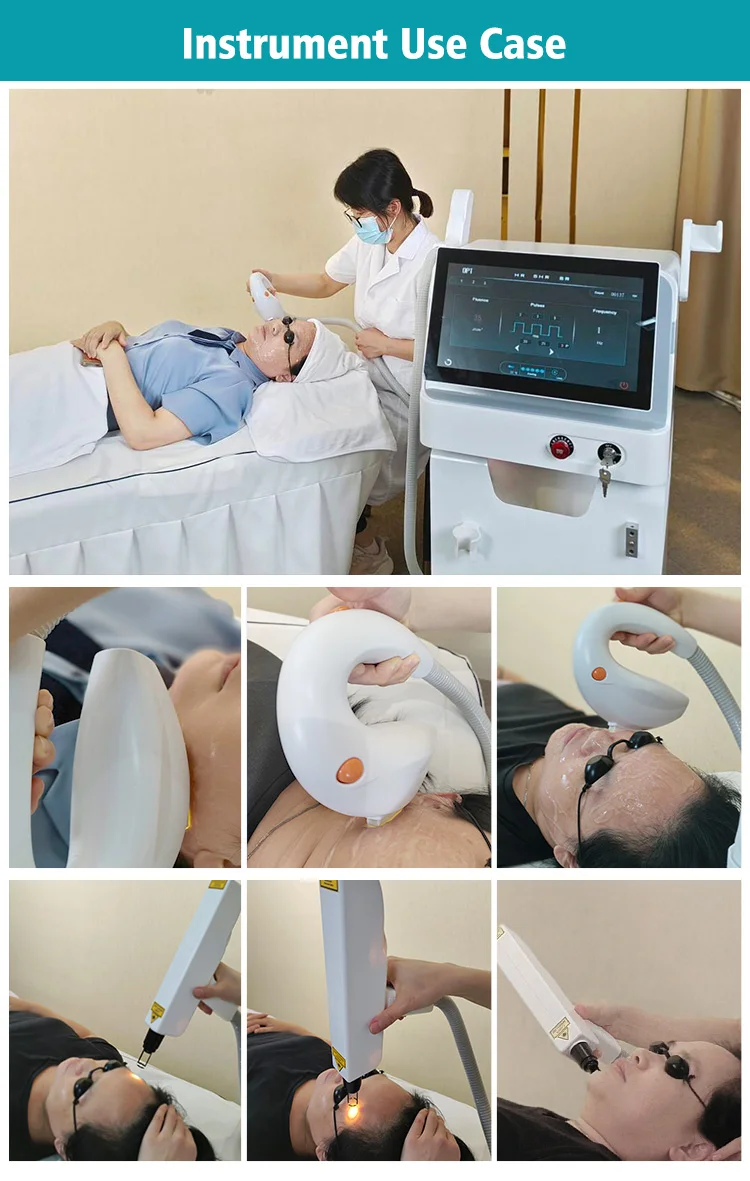 Portable 2 in 1 Q-SWITCH Tattoo Removal Carbon Peeling Skin Whitening Machine/ Fast IPL Hair Removal Machine