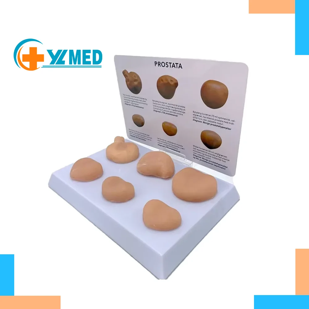 6pcs PVC Human Disease Pathological Prostate Simulation Anatomy Medical Model