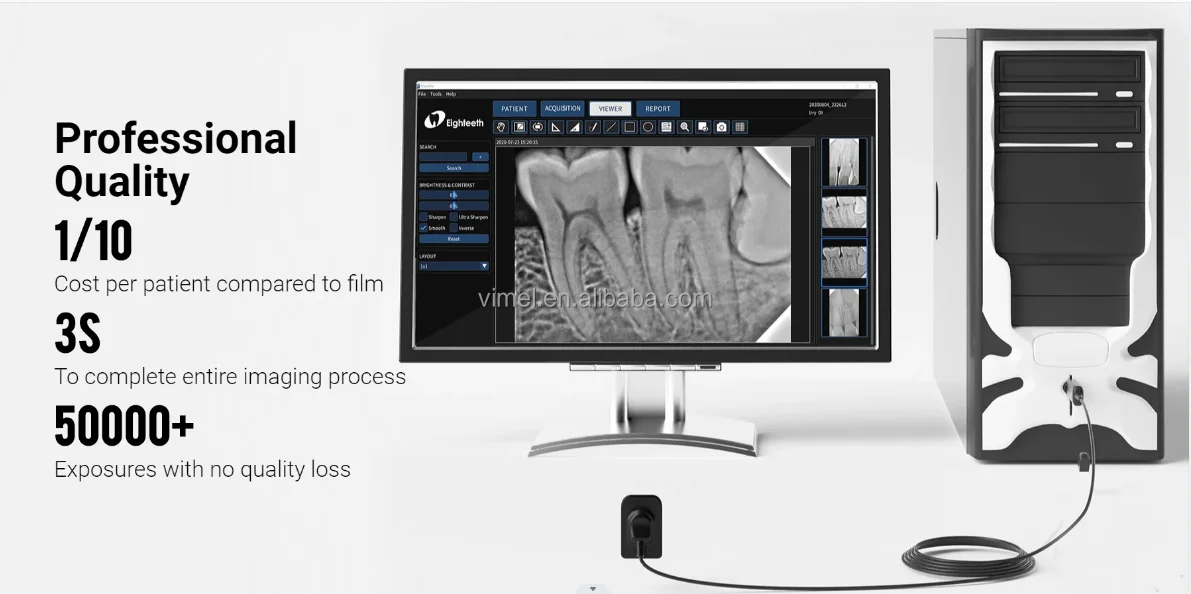 Dental Equipment Eighteeth Hyperlight Portable Xray Machine With