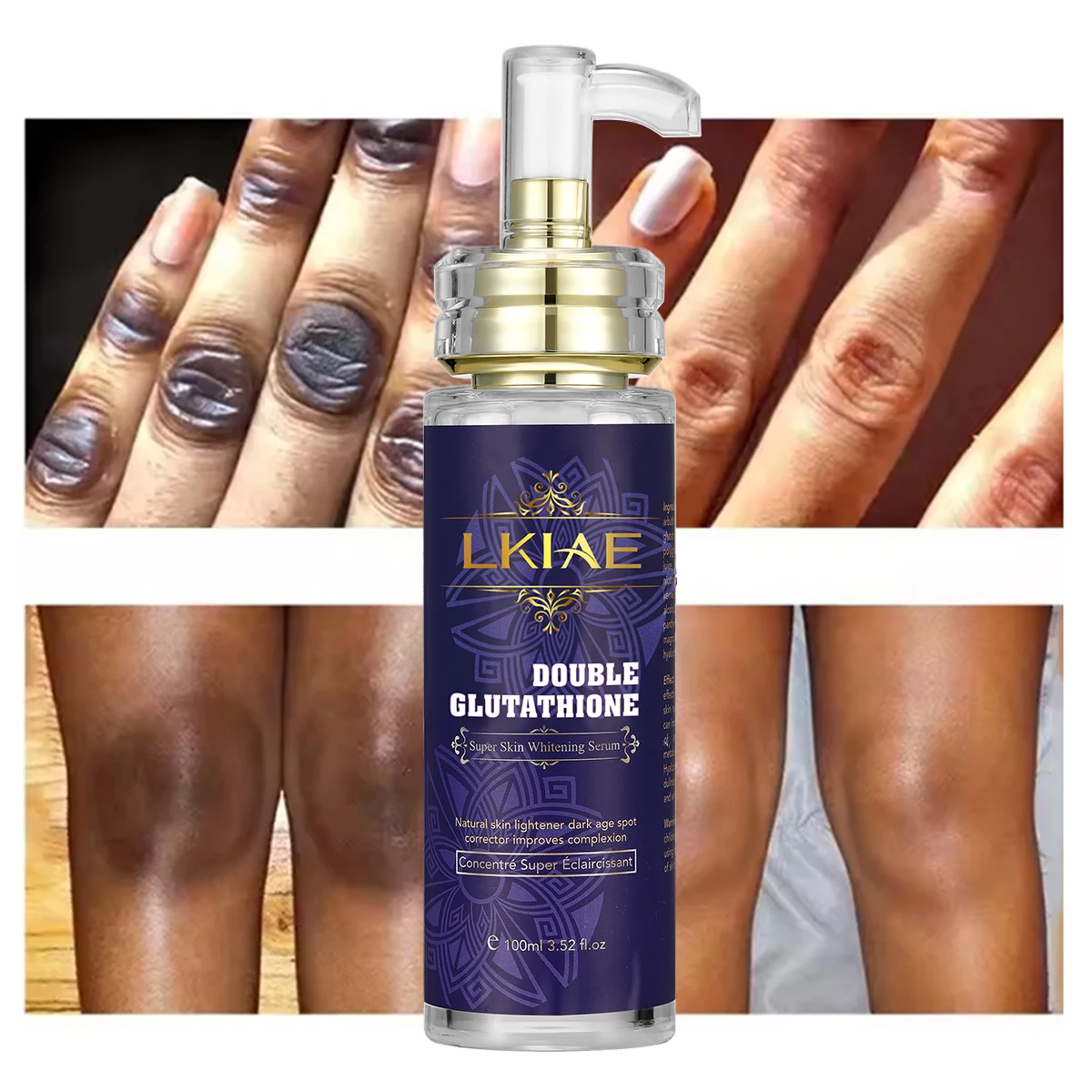 Private Label Double Glutathione Improve Complexion Face Rejuvenating Dark  Spot Vitamin C Anti Aging Skin Whitening Serum
