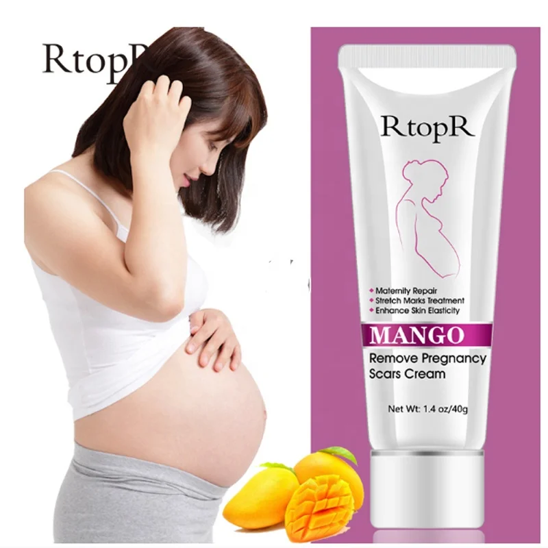 mango anti stretch mark cream