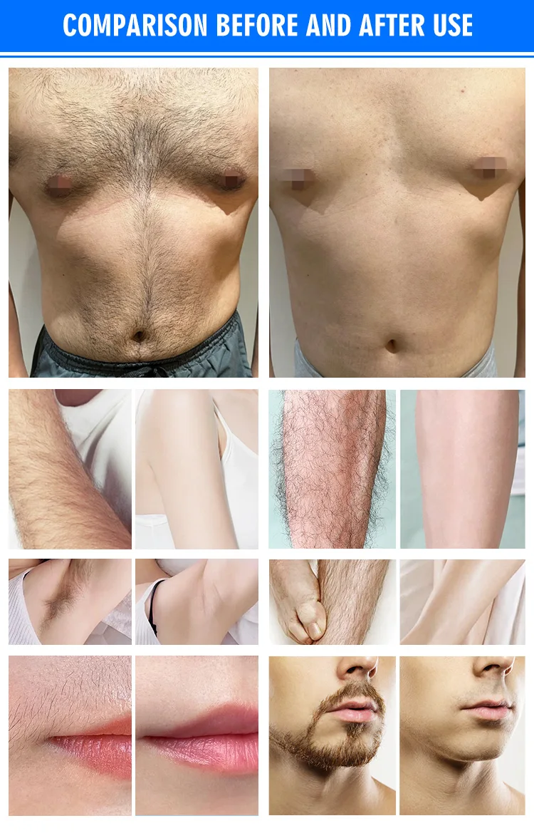 Professional 808nm Diode Laser Hair Removal Machine With 2500W Power Water Cooling 15.6inch Touch Screen