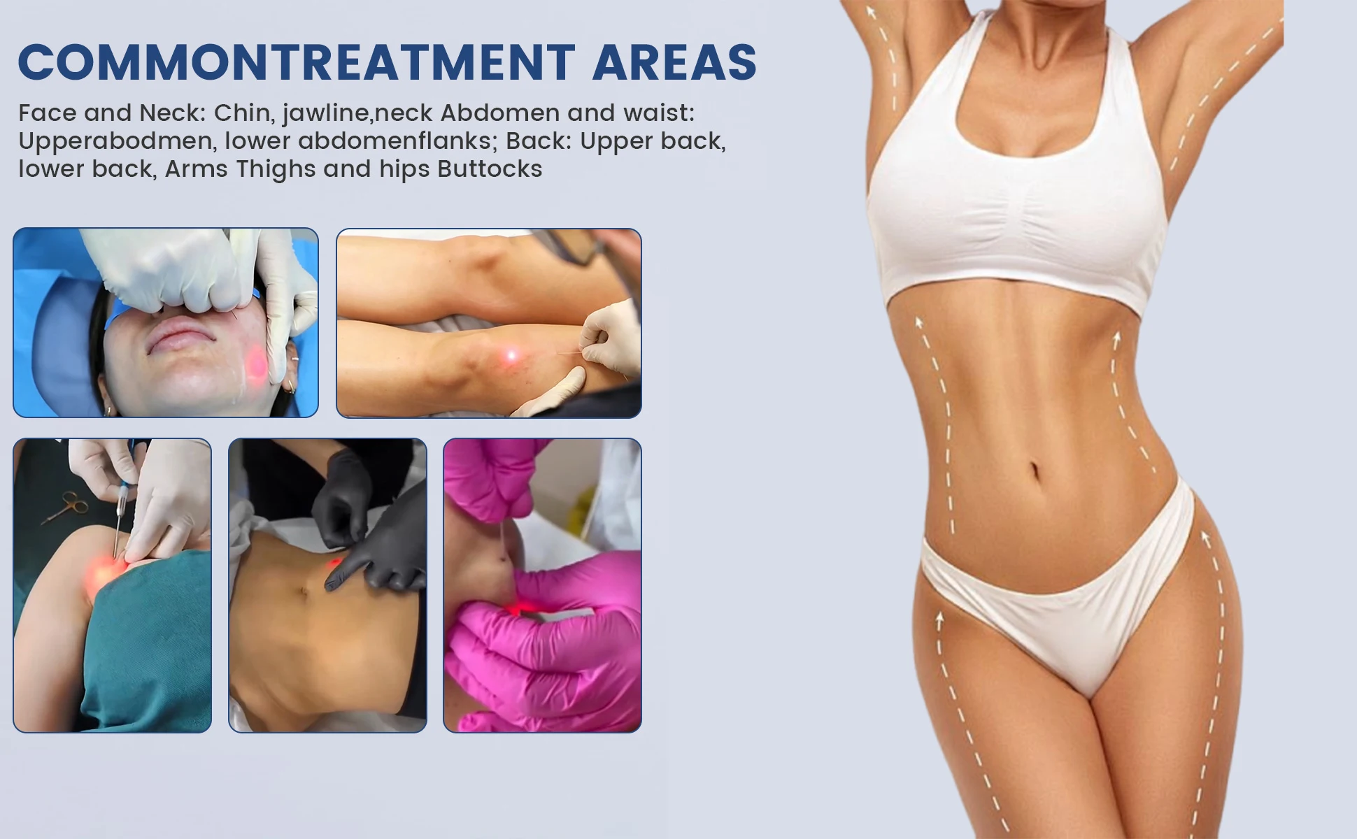 Common Treatment Areas