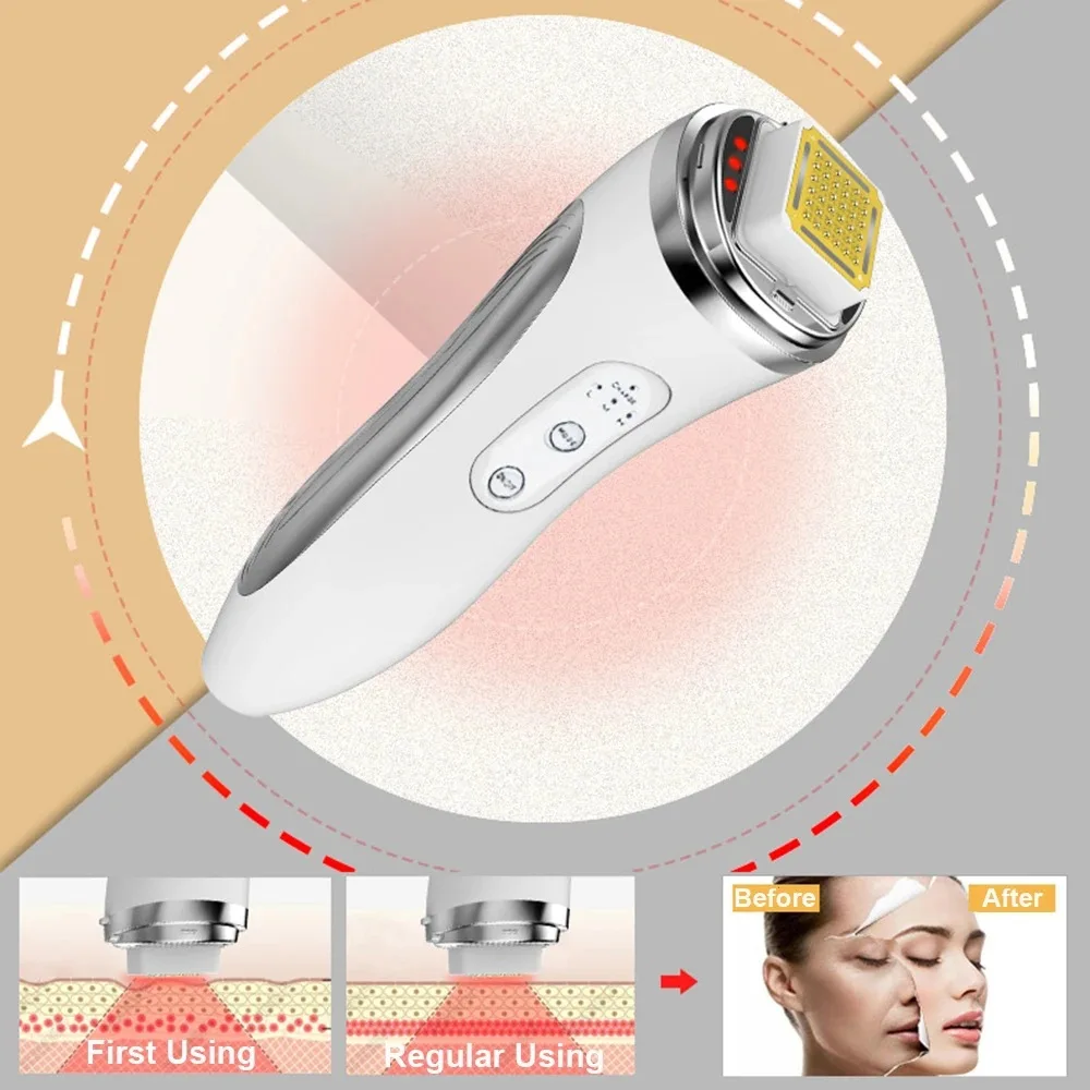 Dot Matrix Handheld Waterproof Skin Tightening Rejuvenation Wrinkle Removal Face Care Device