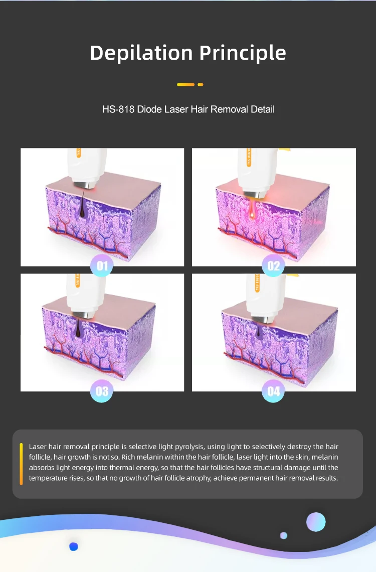 USA 510k Cleared Vertical 755 808 1064 Equipment Triple Wavelength Diode Laser Hair Removal manufacture