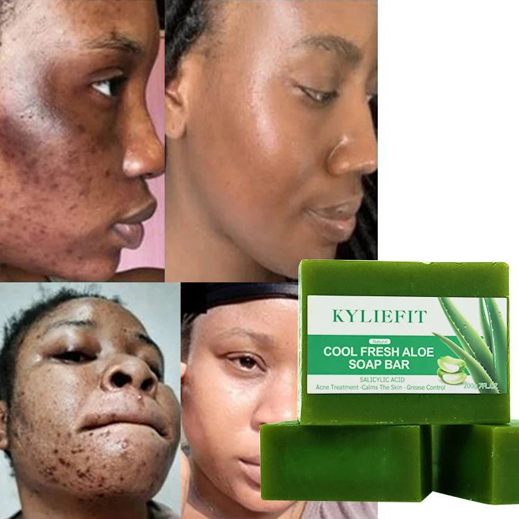 forever aloe vera gel preis Forever Aloe Vera Gel main image 0