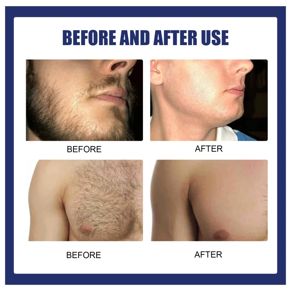 Hair Removal Cream (9).jpg