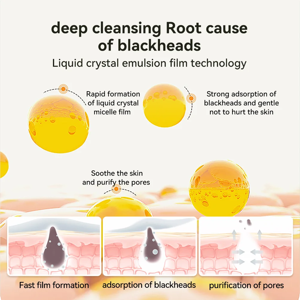 Lanbena Hot Sales Clean Black Head Remove Organic Nose Mask Acne Nose Mask Remove Strips Pore Strip factory