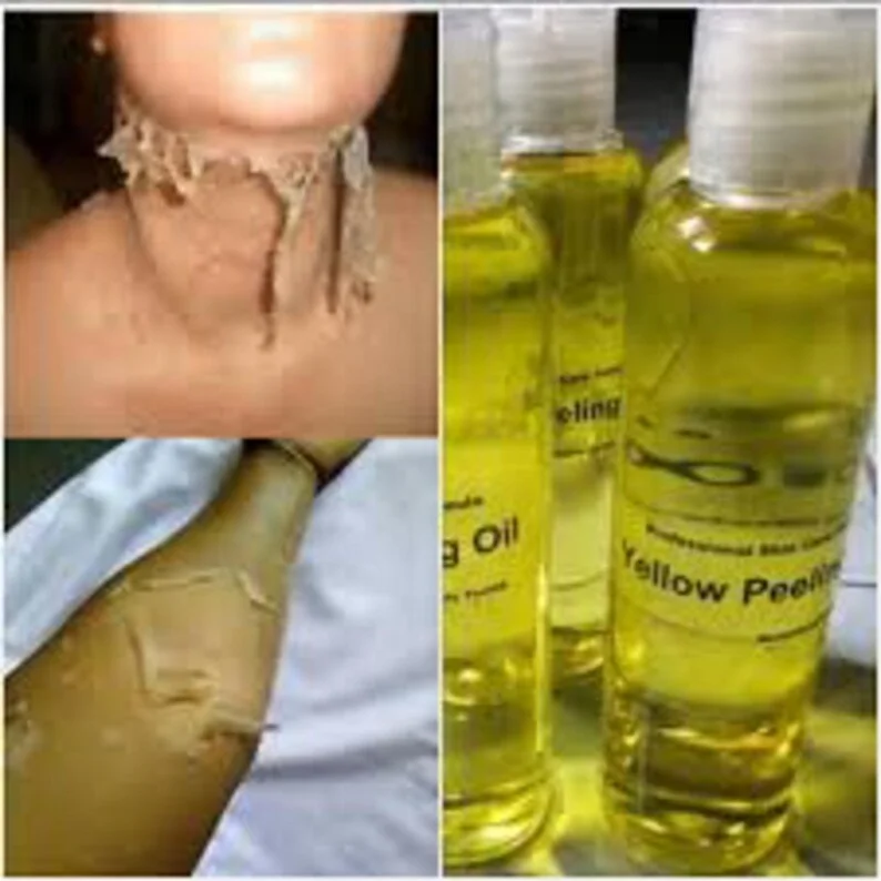 Private Label Extra Strong Peeling Oil Whitening Yellow Peeling Oil