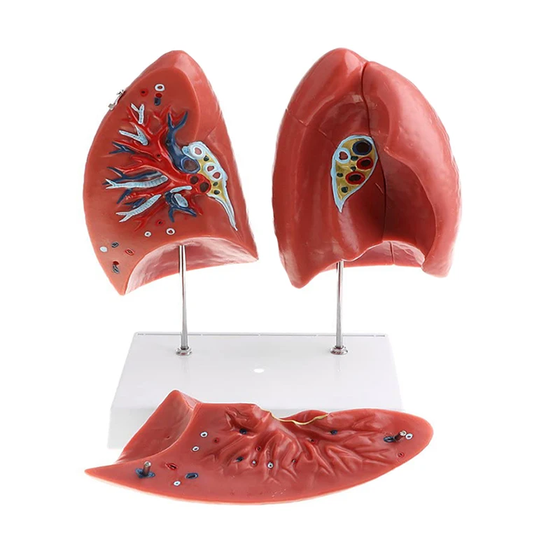 Medical Teaching Used PVC Simulation Human Anatomy Lung Respiratory System Structure Model