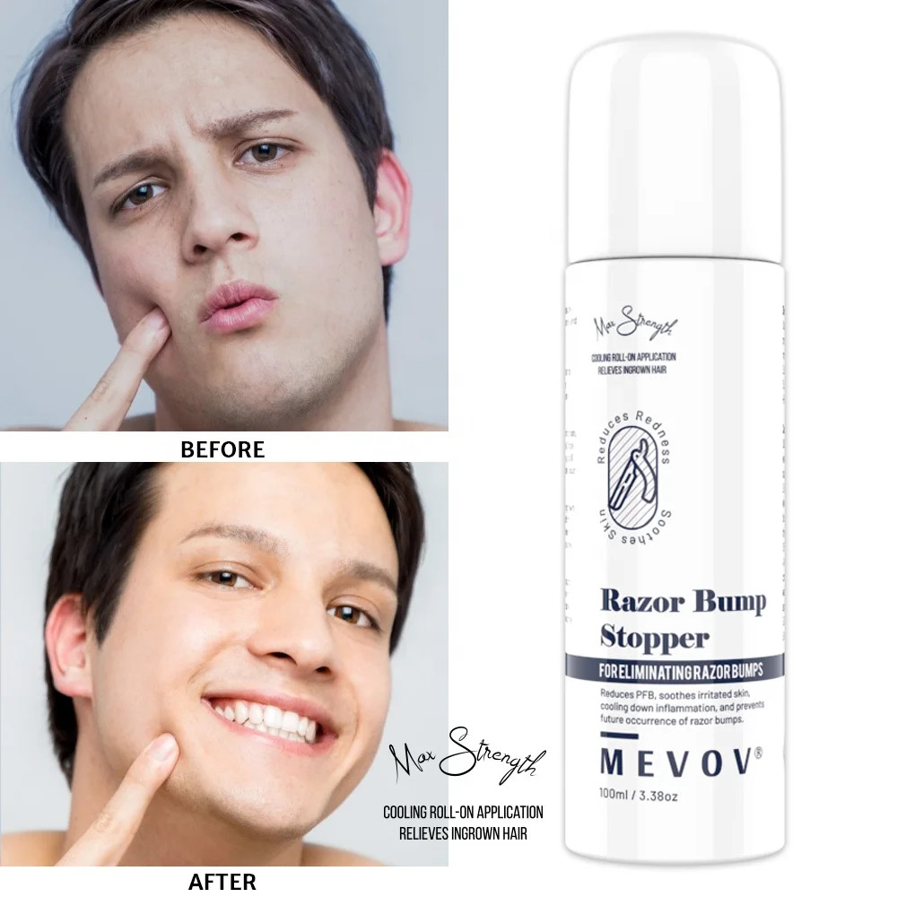 Prevent Razor Burns & Ingrown Hairs with Cooling Aftershave(01)