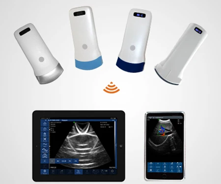 OEM Double Head Linear Small Linear Micro Convex Portable Wireless Mobile Phone Ultrasound Scanner