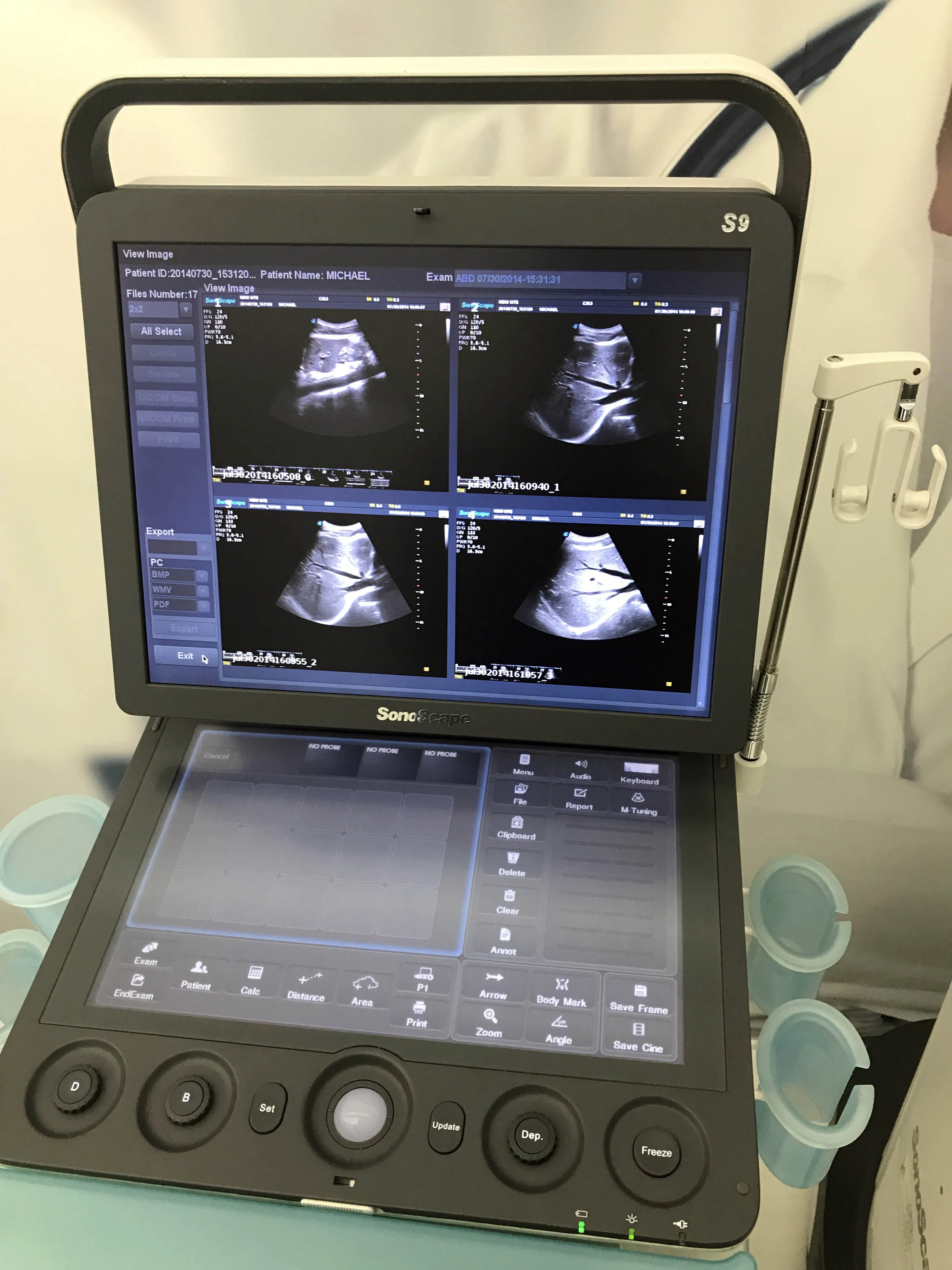 Medical Ultrasound Instruments Ecografo Sonoscape Realtime Ecograf