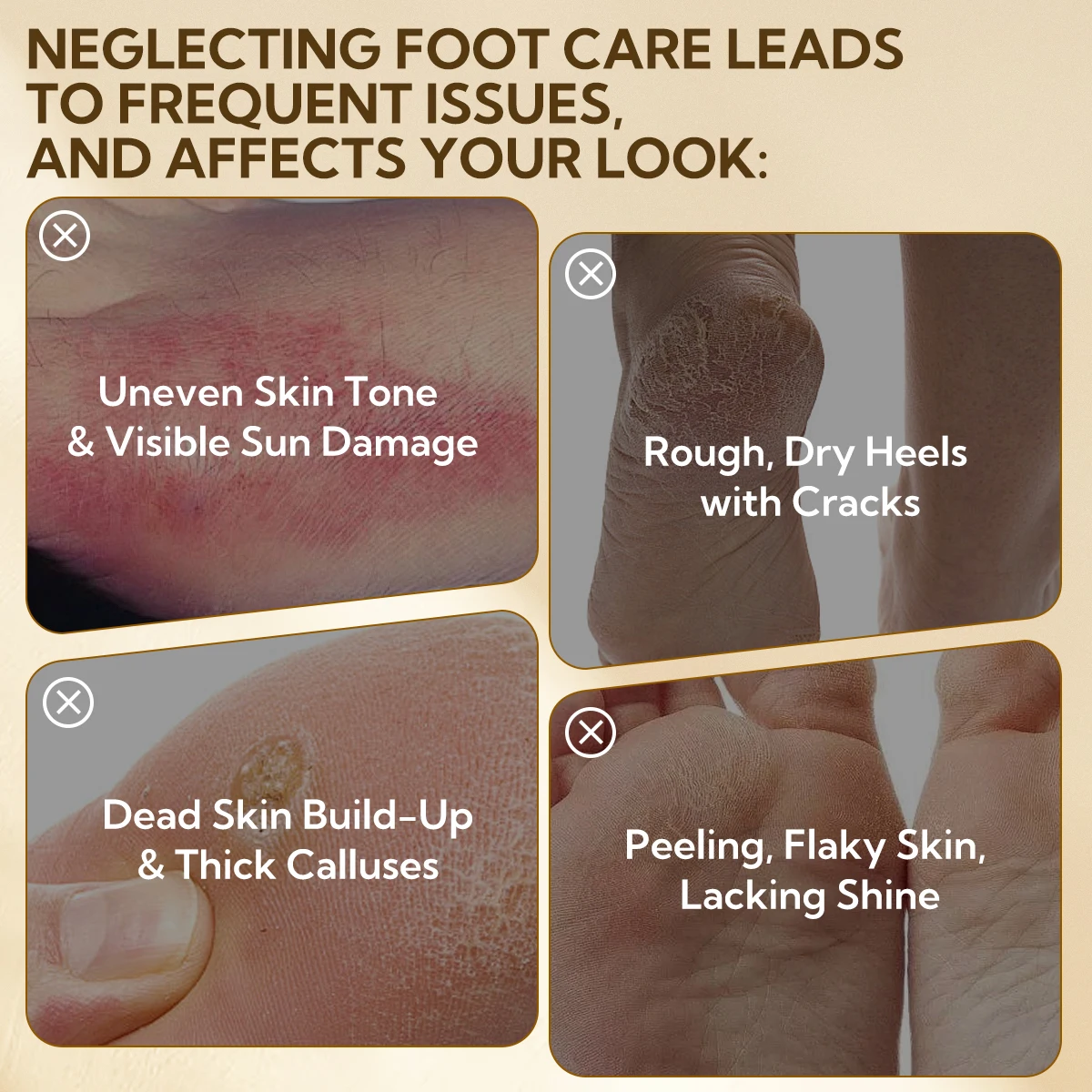 Lanbena Foot Mask for Dry Cracked Feet Dead Skin Remover Exfoliation Foot Peel Mask