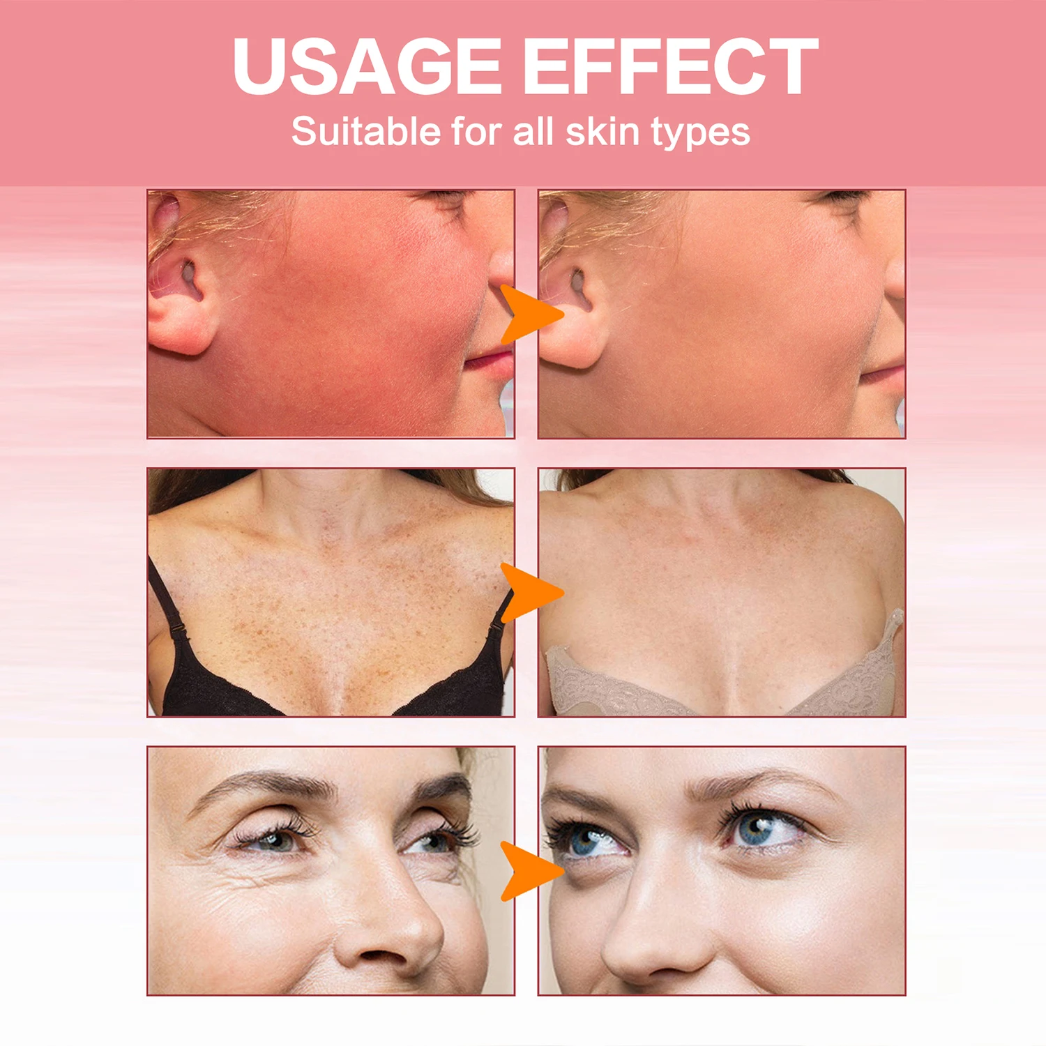 Private Label Anti Uv Cream Waterresistant Face & Body Spf30 Non