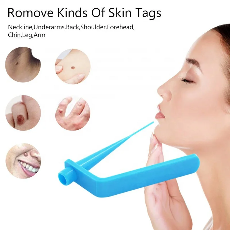 Home Use Low Price Skin Tag Remover Kit to Removal Skin Tags Body Effective Mole Wart Removing Skin Tags