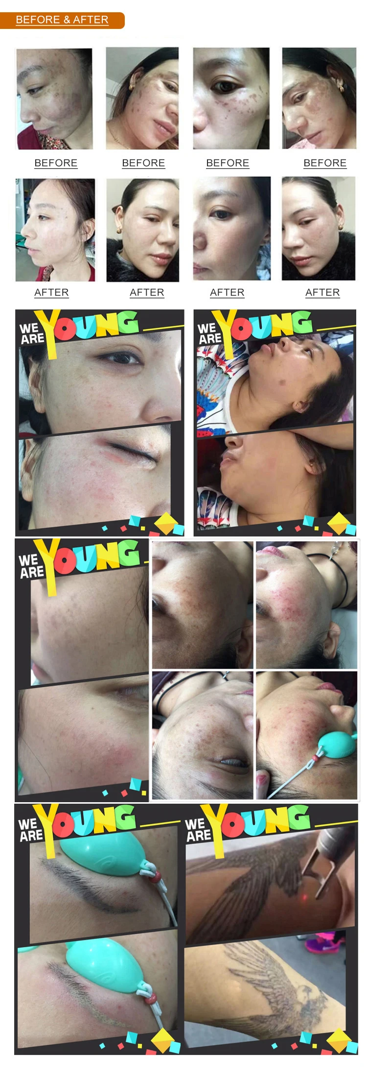 Запечатанное лазерное устройство, имитируемое с помощью лазерной машины с постоянным током CO2 - расстояние 0,1-2,6 мм 6