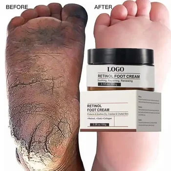 Private order Skin Care for Cracked Heels Exfoliating Skin Rejuvenation Foot Moisturizer Cream