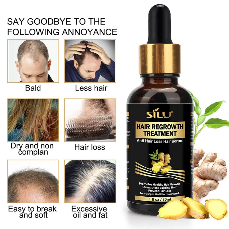 Custom 7 Days Fast Hair Growth Oil Treatment Ginger Hair Regrowth Serum of Hair Loss