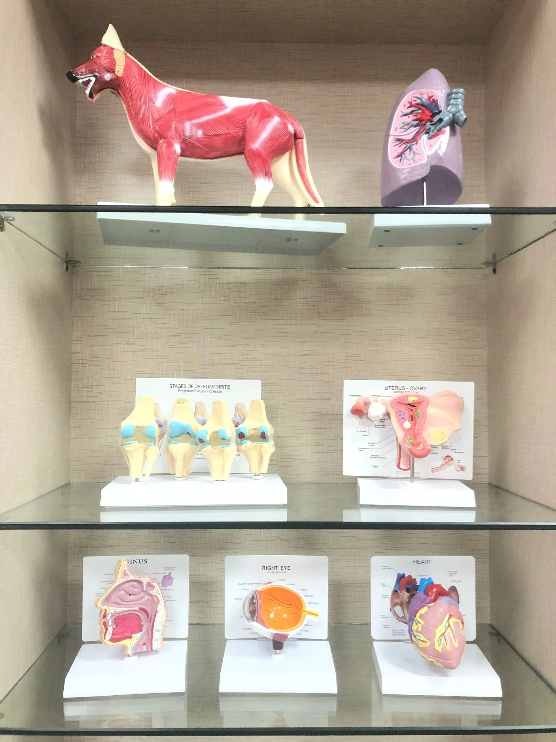 Высококачественная медицинская модель анатомии человека, этапы остеоартрита