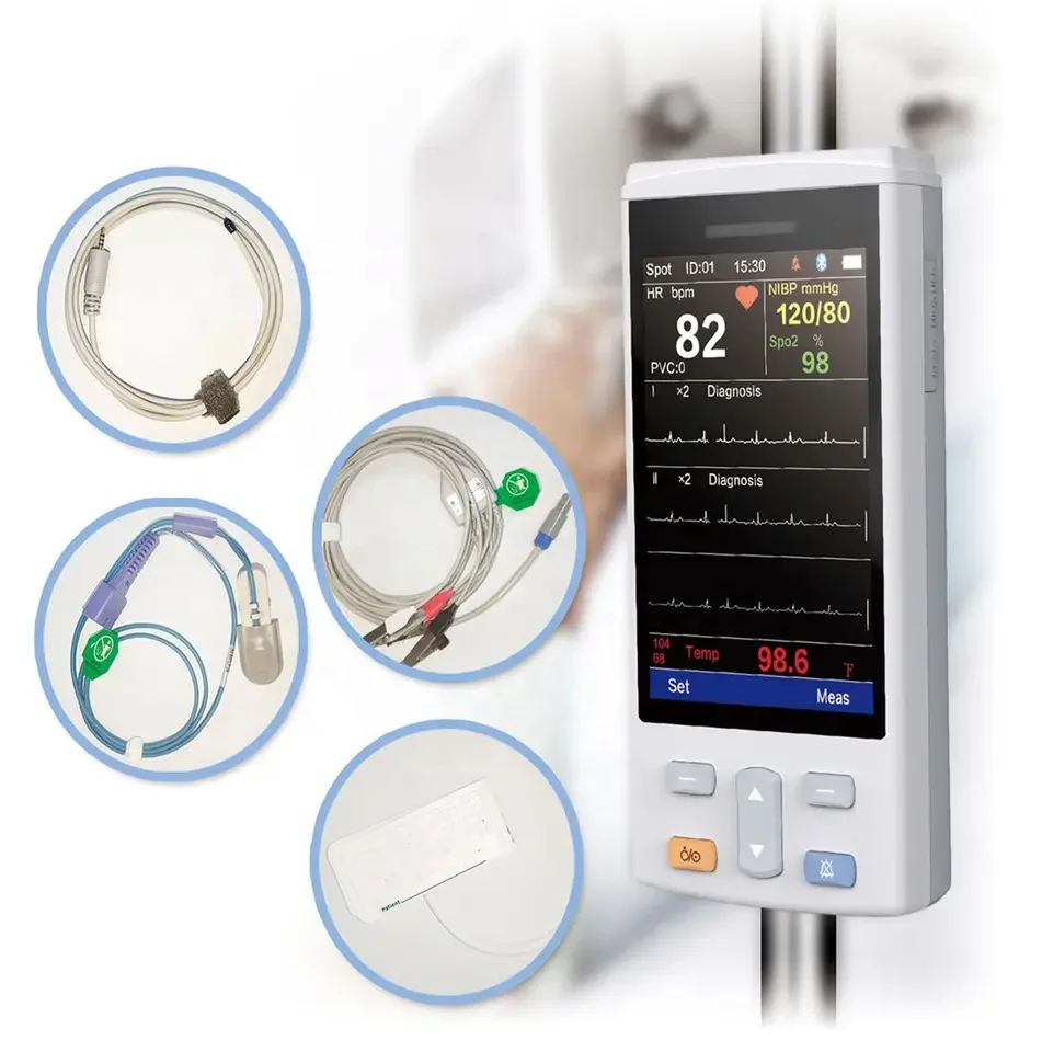 Ddp Veterinary Multi-parameters Ecg Etco2 Handheld Pet Hospital ...