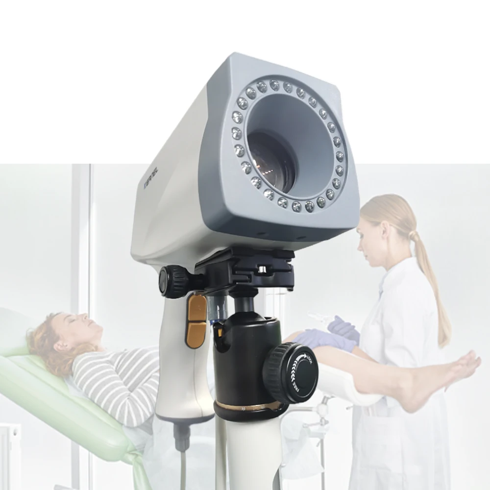 CE Cleared Digital Video Colposcope with Powerful Software Medical Mobile HD Digital Video Colposcope for Gynecology KN-2200