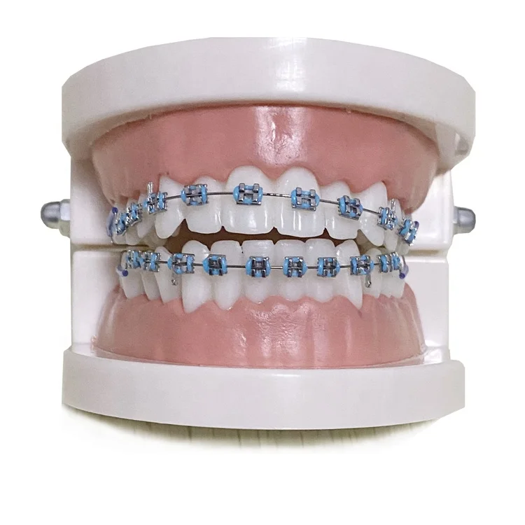 Dental Equipment Orthodontic Mini Roth Fashion Fake Braces For Teeth