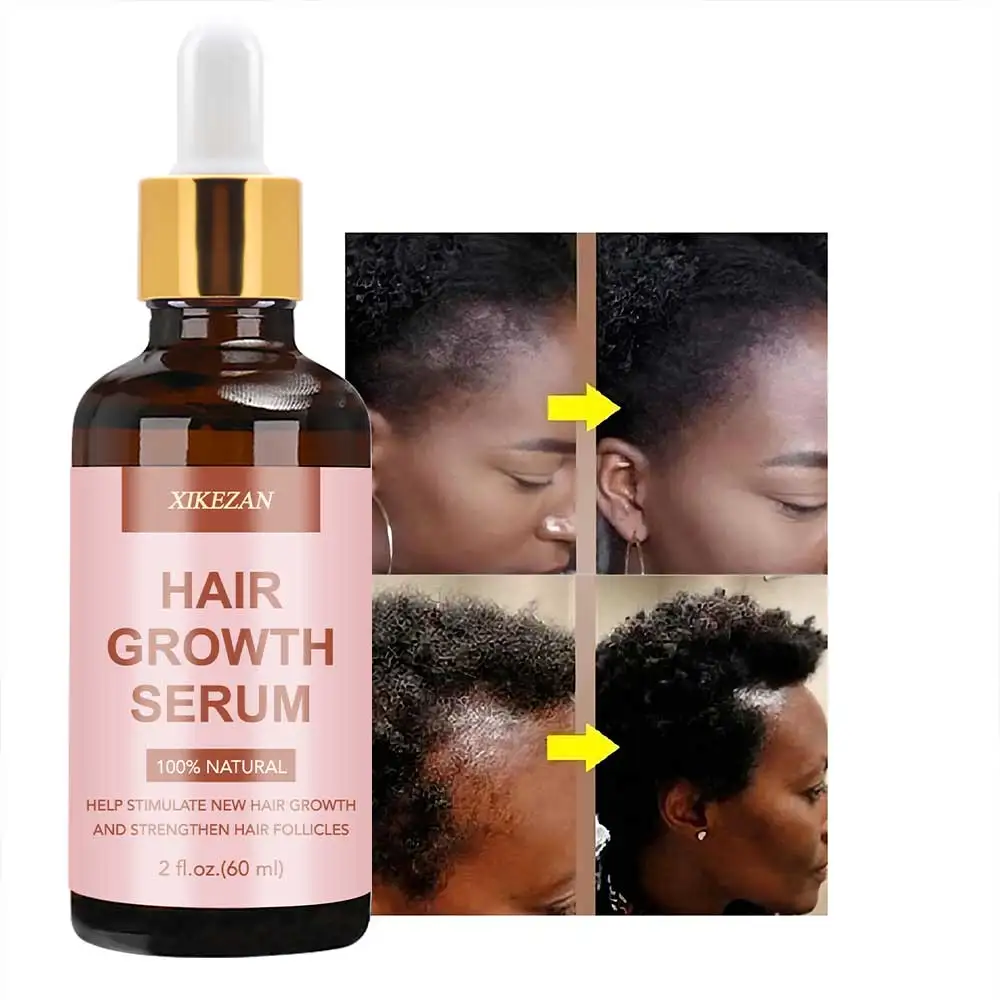 OEM Luxury Hair Scalp Serum - Vegan Caffeine & Shea Moisture