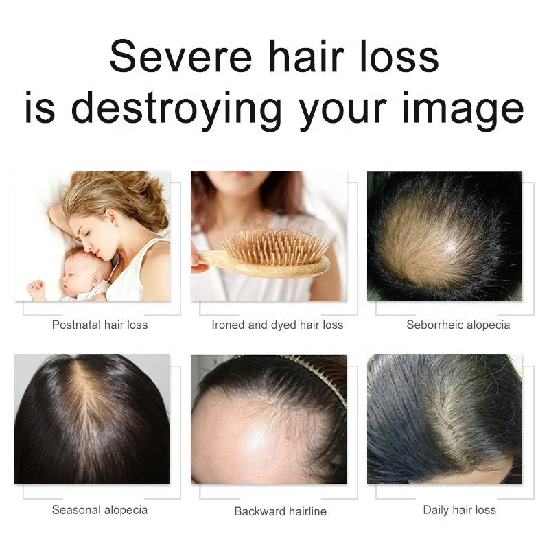 Новое поступление питательное укрепляющее поврежденное восстанавливающее против выпадения волос эфирное масло для