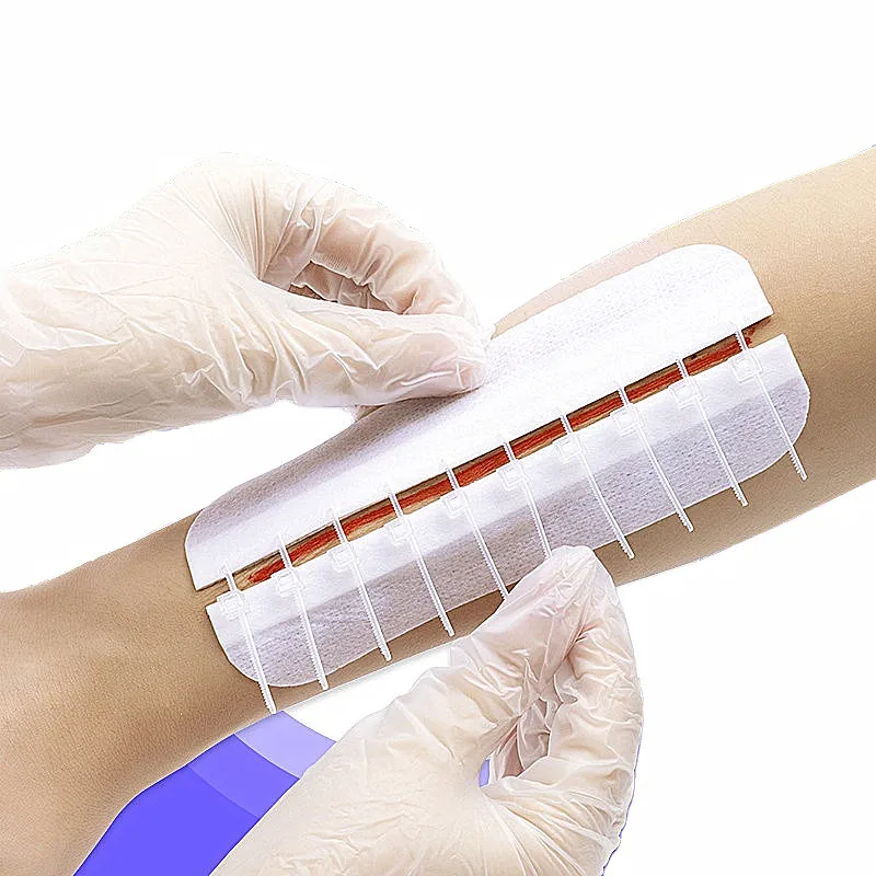 Wound Device Zip Wound Closure Wound Splice Closure