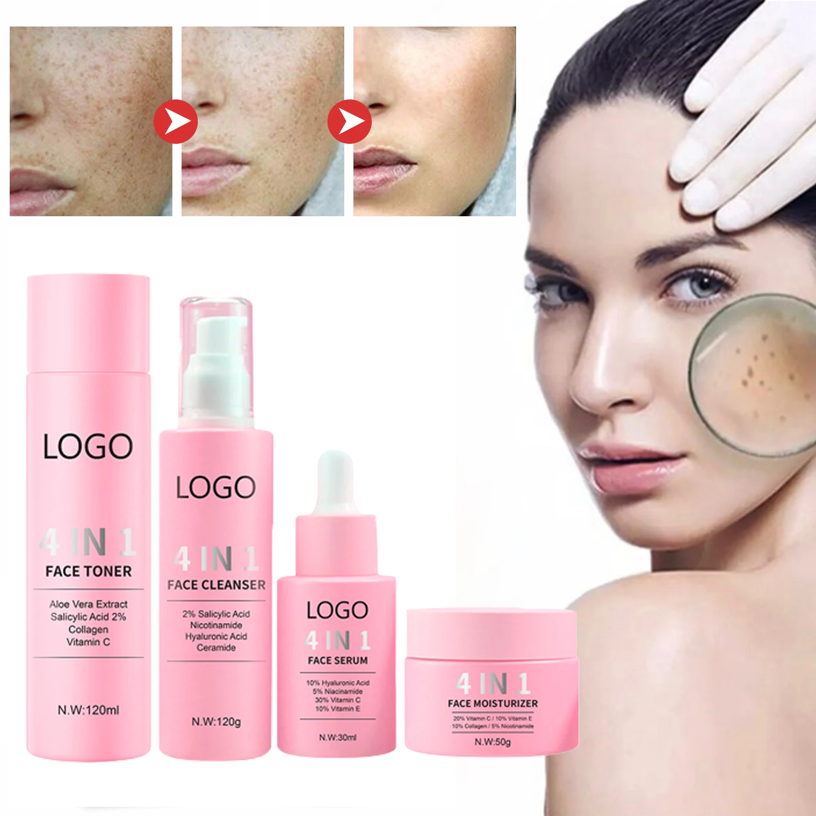 Wholesale 4 In 1 Skin Whitening Cream Set Vitamin C Dark Spot Removal ...