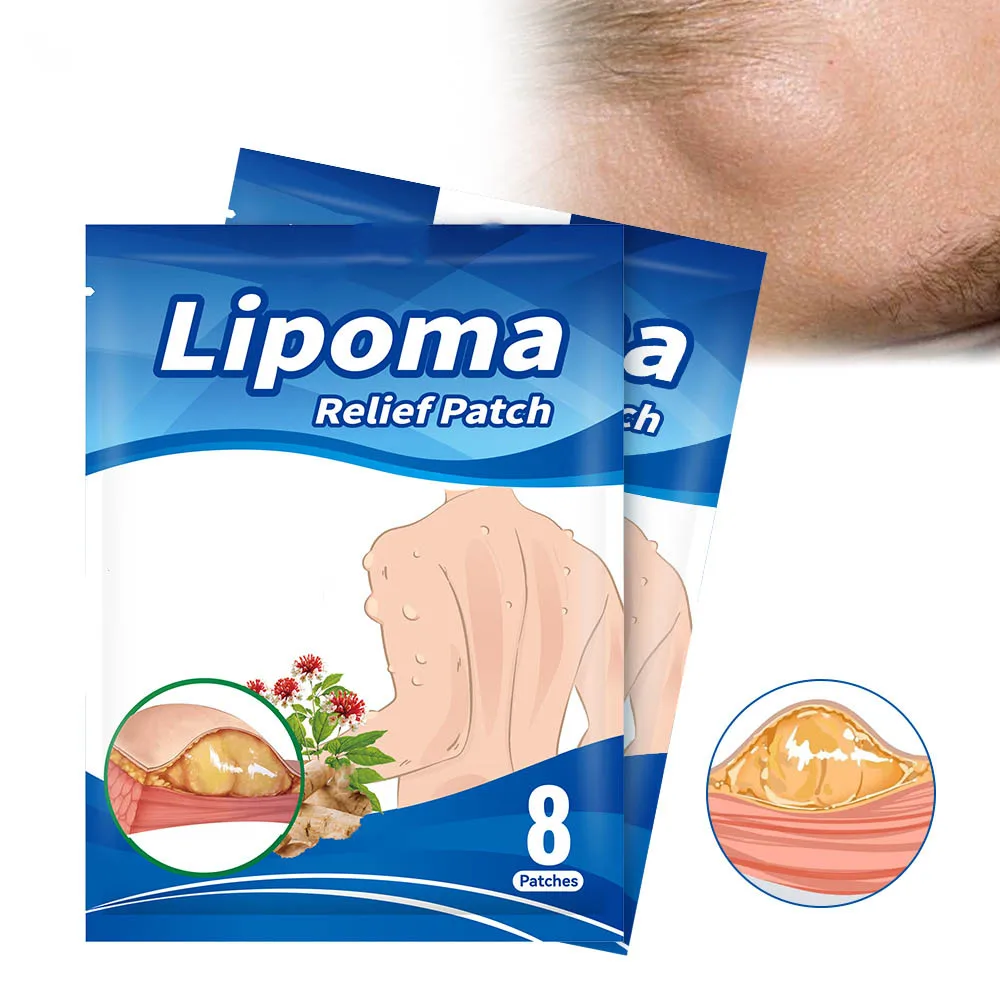 Хит продаж, натуральные травяные Пластыри для удаления комков Липомы, пластыри против набухания лимфатической детоксикации