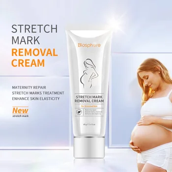 Private Label Stretch Marks Removal Cream Maternity Repair Nepal Price Anti Scar Removal Cream Effective And Stretch Mark