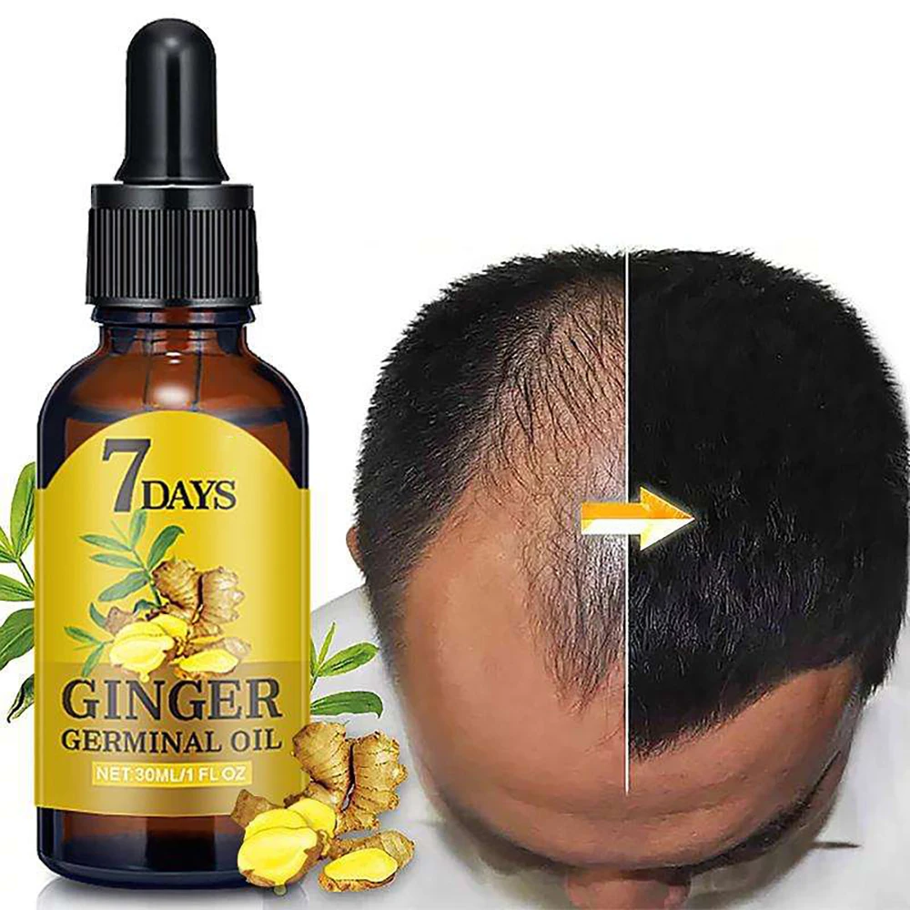 Wholesale 30ml Ginger Oil 7 Days Hair Growth Essential Oil For Hair
