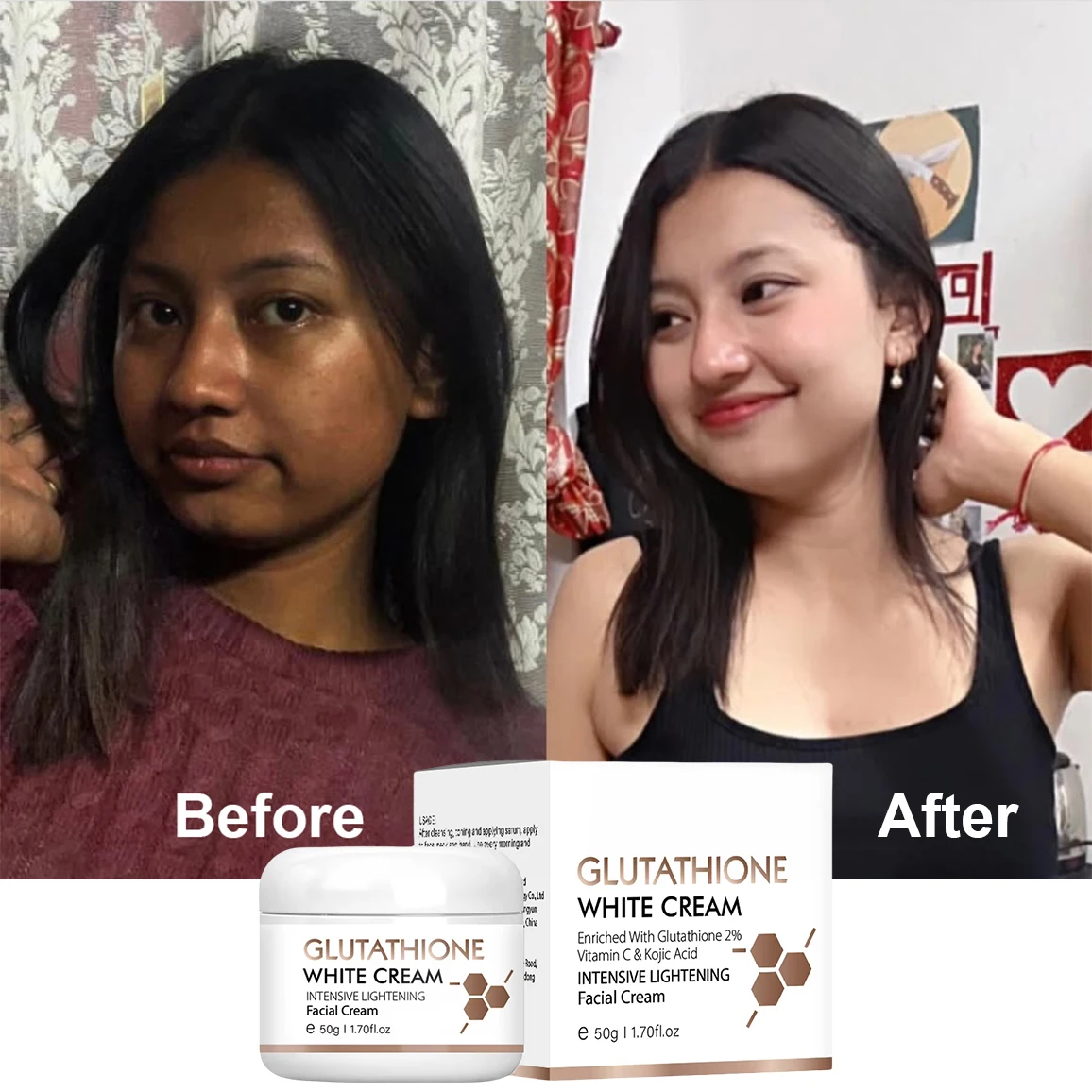 glutathione does it whiten skin Skin Whitening After Glutathione (Antioxidant) Treatment main image 0