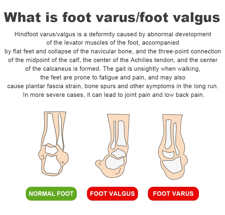 Princepard Orthopedic Shoes For Kids - High-Top Corrective Sneakers With Arch & Ankle Support For Flat Feet & Walking Issues